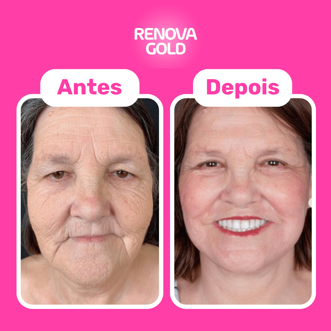 renova-gold-antes-depois-cliente.png